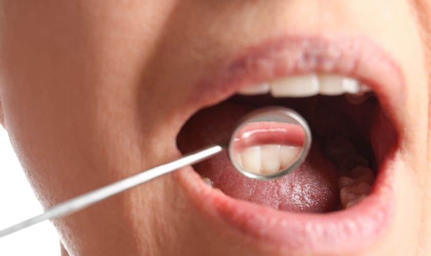 Is Oral Cancer Painful?